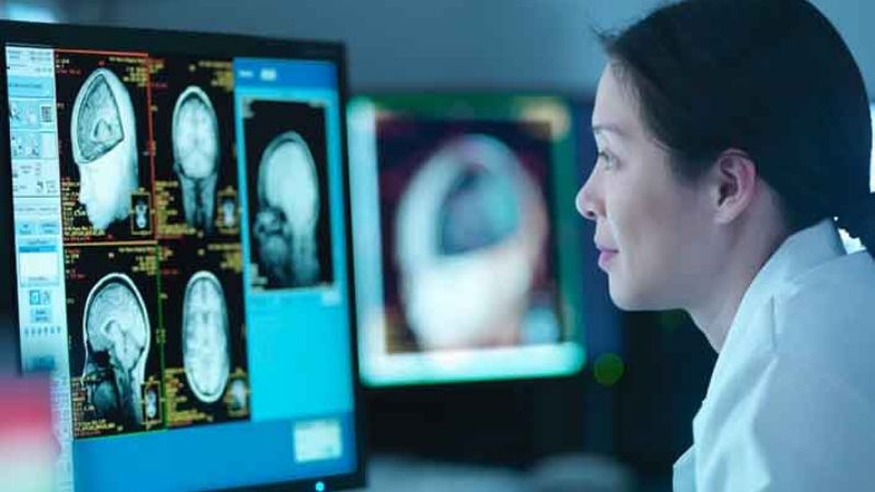 Alzheimer: la inteligencia artificial  puede detectar signos tempranos