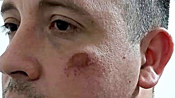 Juntadas en todas partes y varios policías golpeados