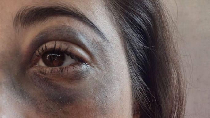Juzgarán a un policía acusado de golpear a una motociclista