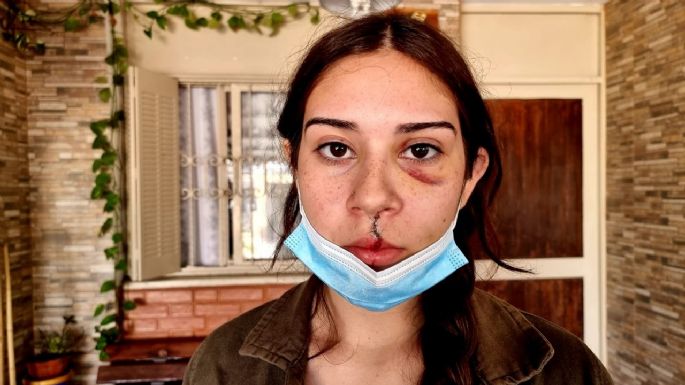 Analizan las cámaras de seguridad tras la denuncia de abuso policial