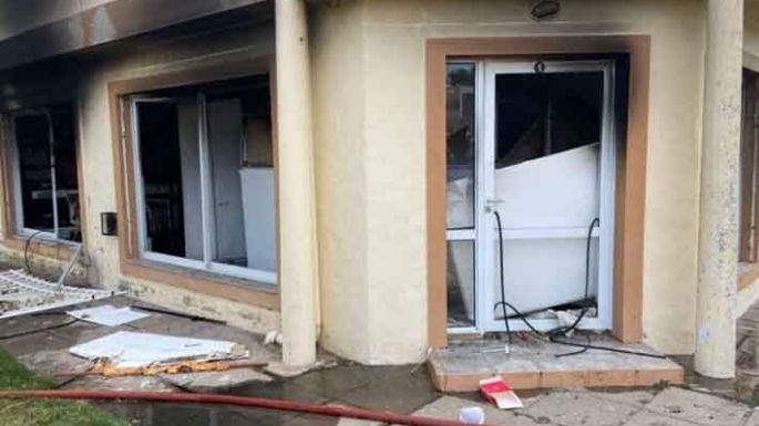 Una mujer sufrió graves quemaduras