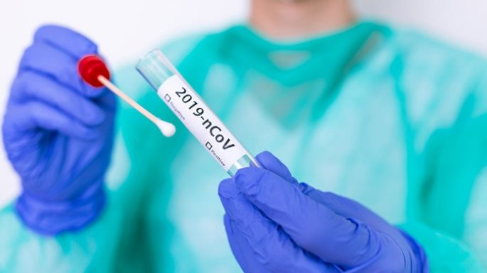 Argentina: 86 muertes y 7.849 nuevos contagios por Covid-19
