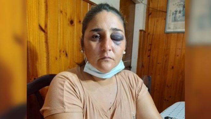 Agredieron a dos mujeres