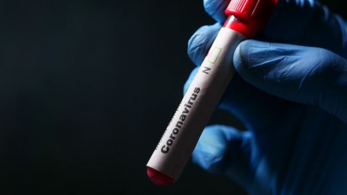 Coronavirus en Argentina: 126 personas fallecidas y 6.401 fueron diagnosticadas