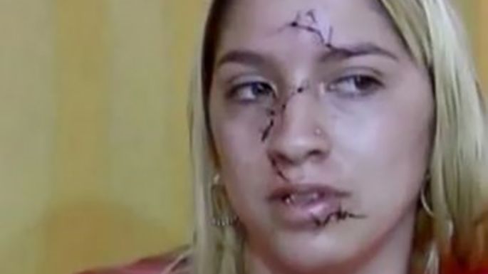 Desfiguraron la cara de una joven