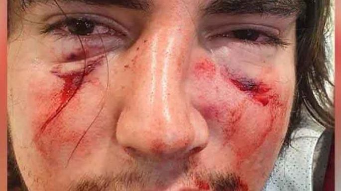 Dos rugbiers a juicio por golpear a un joven