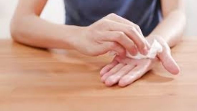 ¿Qué es la hiperhidrosis?