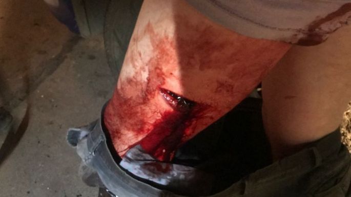 Noche violenta: agredió con un hacha a supuesto violador de su hija