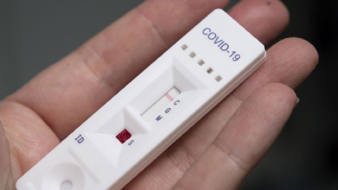 Los primeros autotest de Covid estarían disponibles la próxima semana en farmacias
