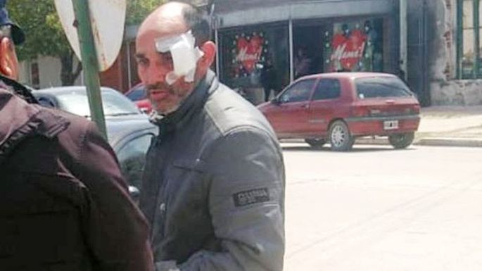 El Negro Videla denunció que un policía le golpeó la cara con un palo a su chofer