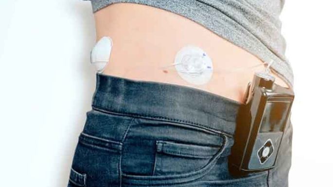 Diabetes: ¿cuáles son los avances?