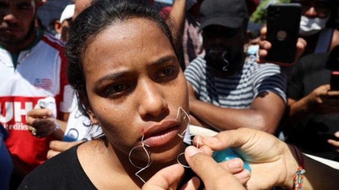 Migrantes se cosen la boca en protesta