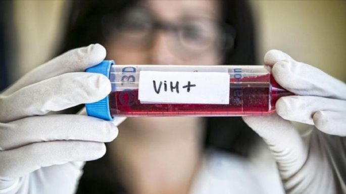 Identifican una variante del VIH más virulenta