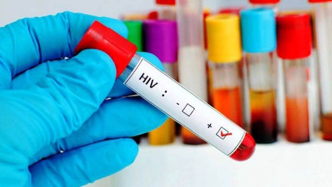 VIH: en busca de una nueva ley