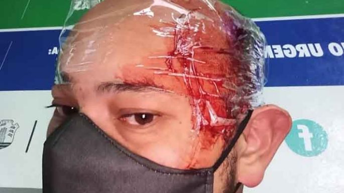 Lo atacaron a ladrillazos para robarle el sueldo