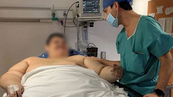Obesidad: obras sociales y prepagas deberán cubrir tratamientos específicos