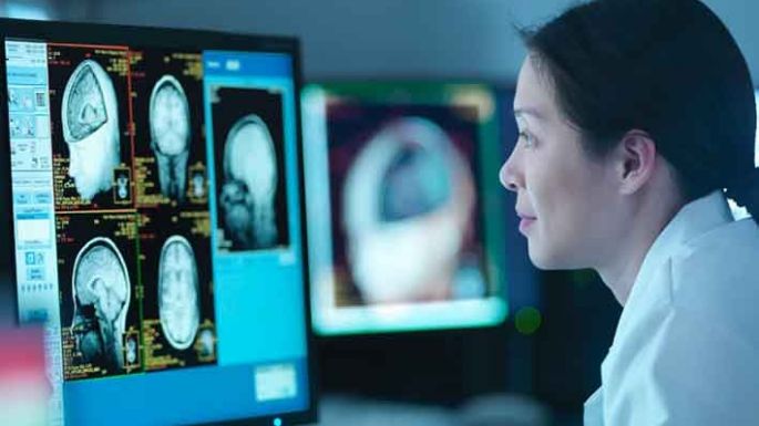 Alzheimer: la inteligencia artificial  puede detectar signos tempranos
