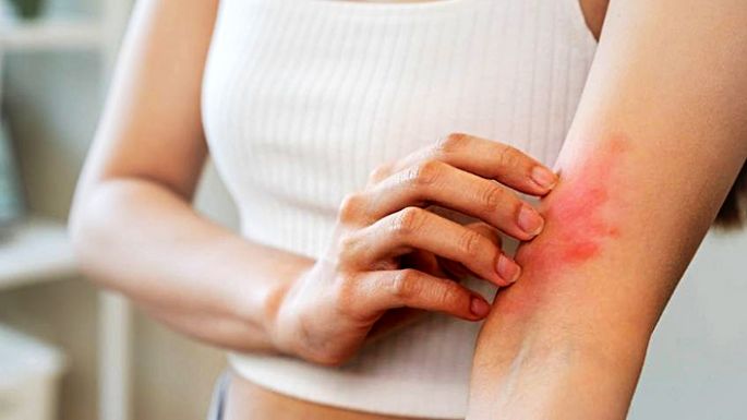 Los impactos de la sequía en la salud
