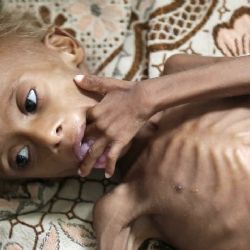 Más de 70 mil niños sin alimentos