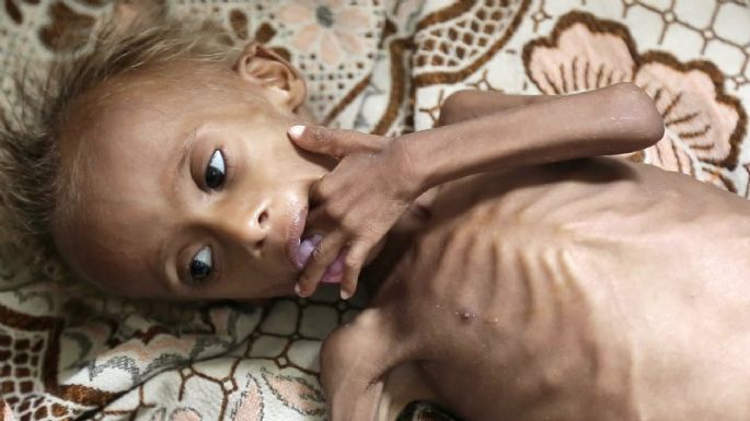 Más de 70 mil niños sin alimentos