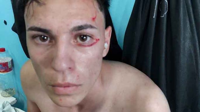 Brusa sigue detenido y será  indagado hoy por el fiscal Bosio