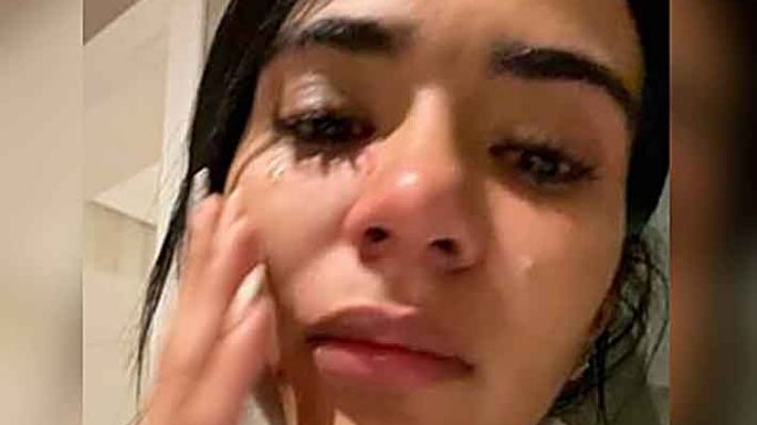 La expareja declaró que le pegó en la frente y patadas en el estómago
