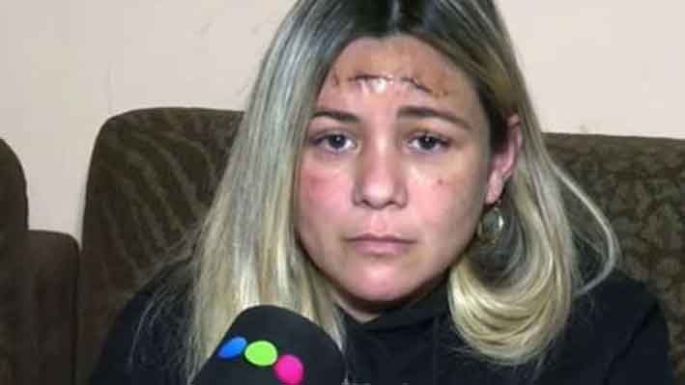 Córdoba: le dispararon en la cabeza, logró sobrevivir, pero tuvo que irse de su casa