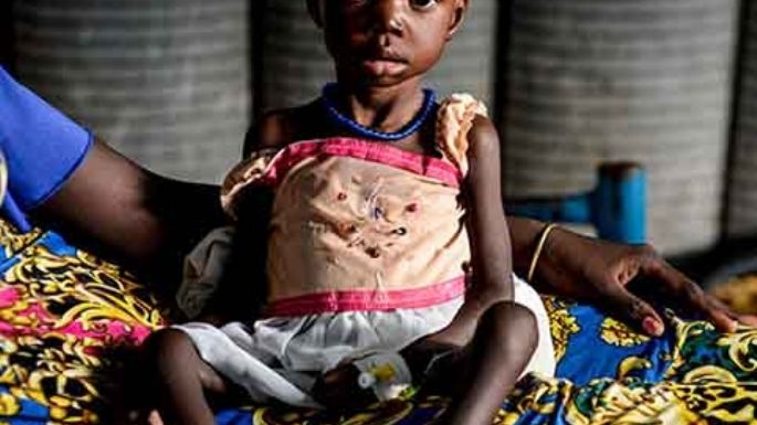 Casi 500 niños murieron de hambre durante los últimos cuatro meses