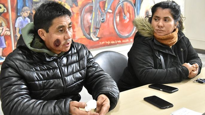 Le desfiguró la cara de una mordida