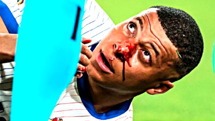 Mbappé, de la lesión a la chance de seguir jugando