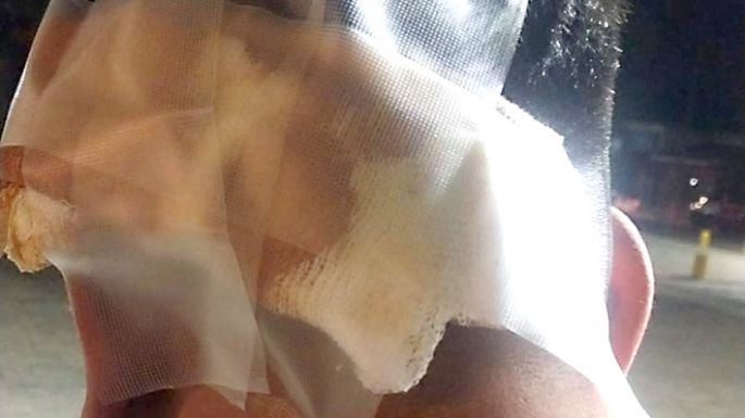 Pelea callejera terminó con un joven herido de un machetazo