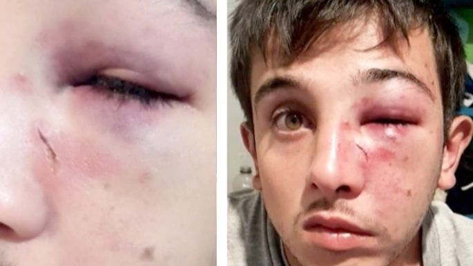 Una patota le dio una feroz golpiza en un local bailable
