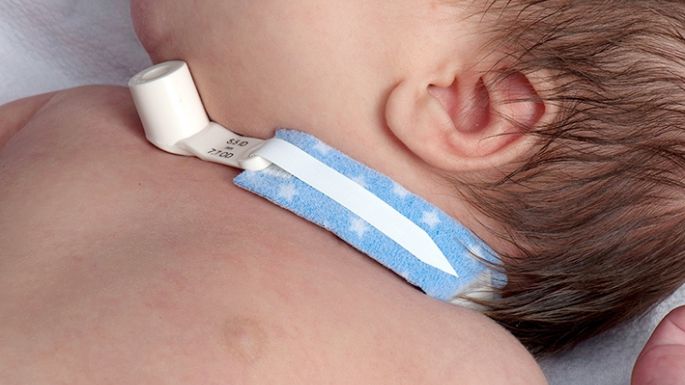 “Pusieron en riesgo la vida de mi hijo”, dijo una mamá