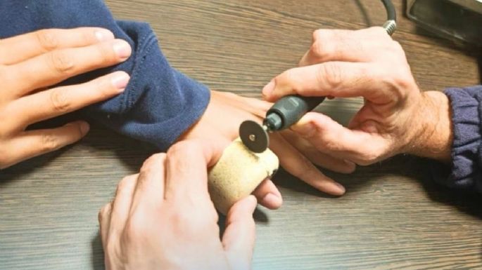 Los Bomberos asistieron a un menor con un dedo atrapado en una rueda de skate