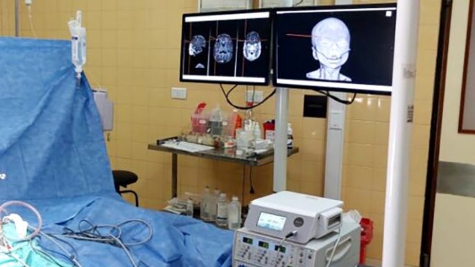 Investigan el caso de un bebé de dos meses que sufrió fractura de cráneo