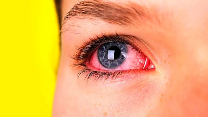 Crecen los casos de Fiebre Hemorrágica en la región